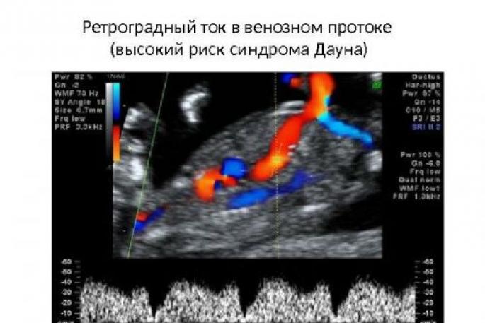 Комплексное обследование беременных женщин